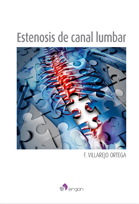 Estenosis de Canal Lumbar