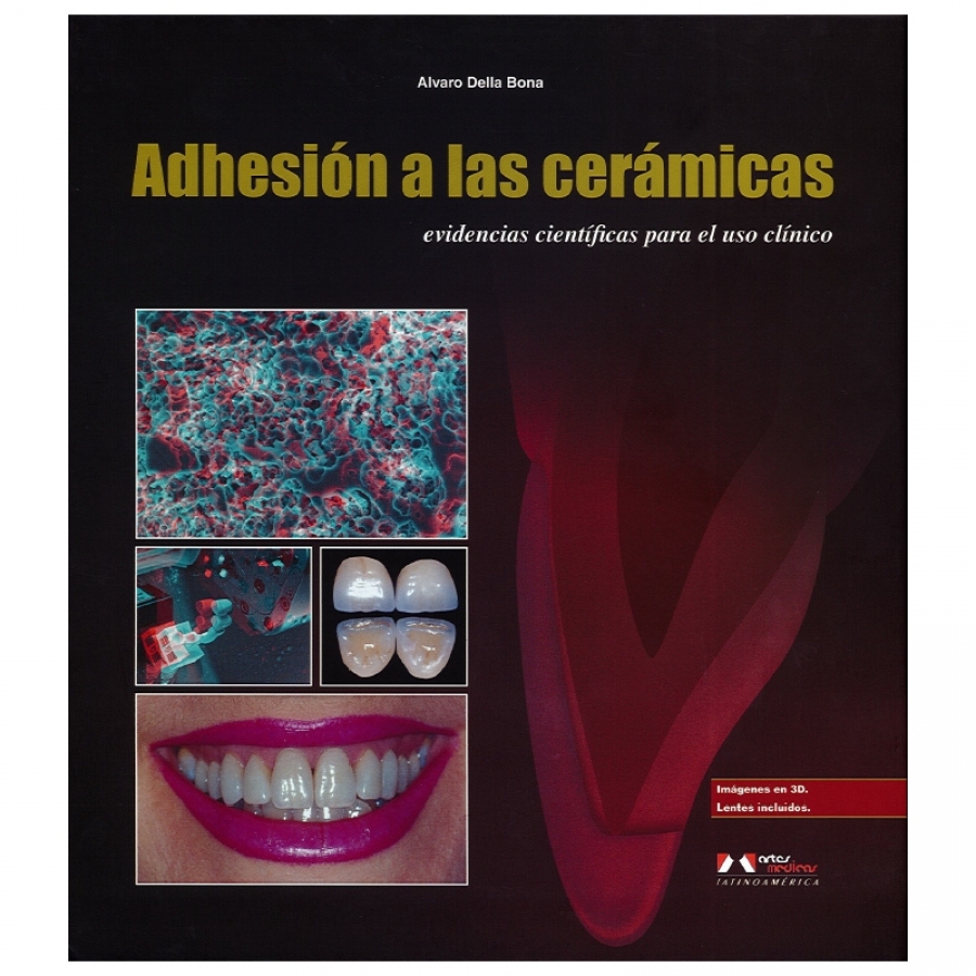 ADHESION A LAS CERAMICAS